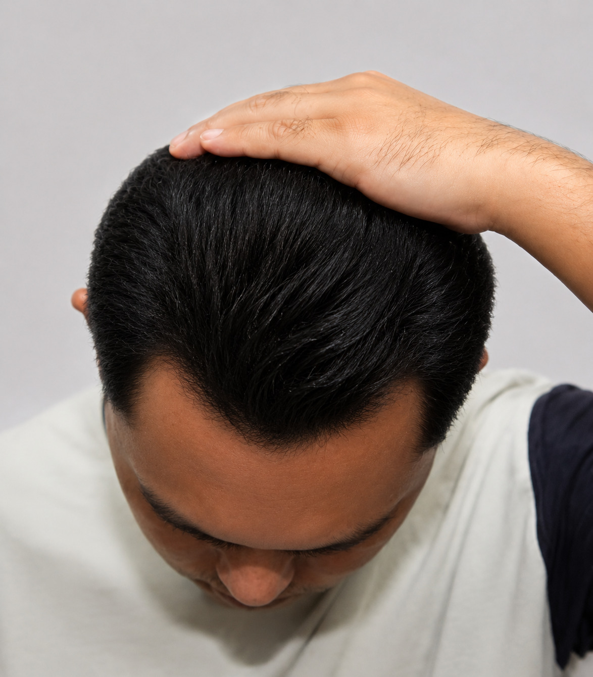 Rambut hitam lebat setelah memakai Donan
