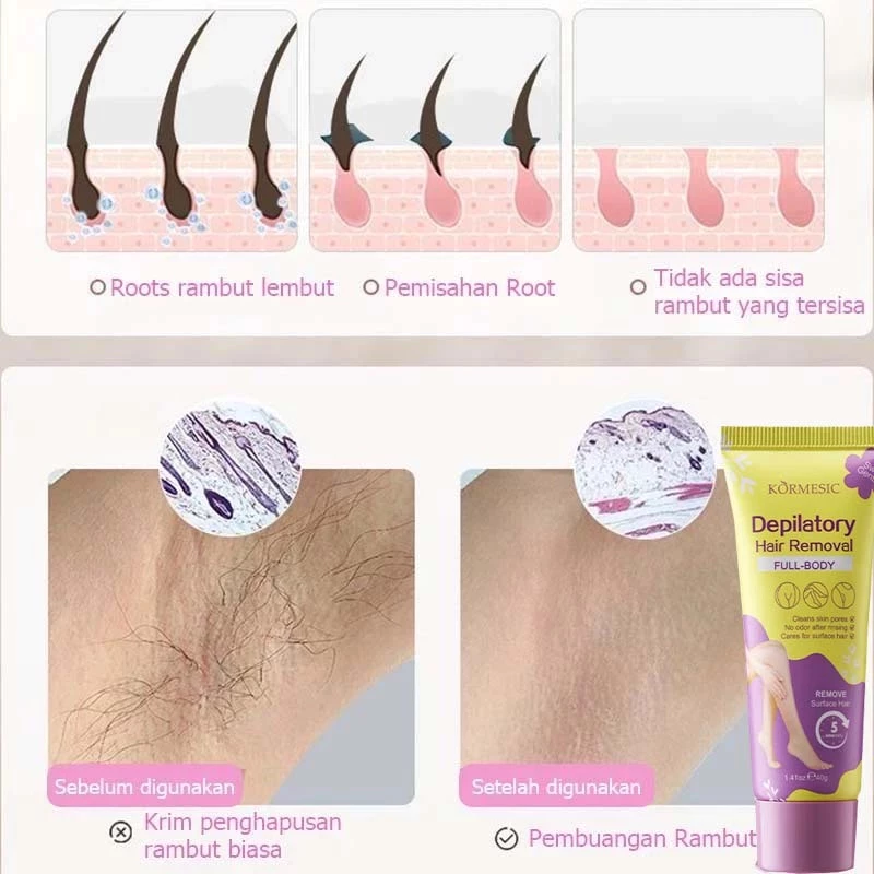 Cara Kerja Kormesic