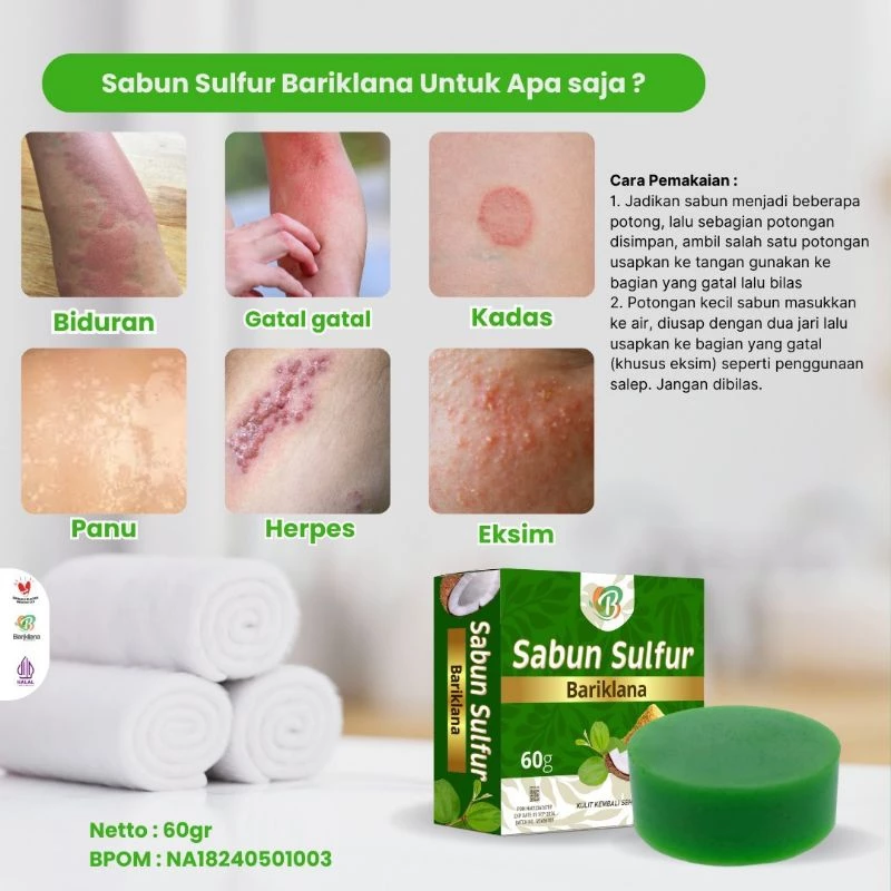 Manfaat Sabun Sulfur Bariklana
