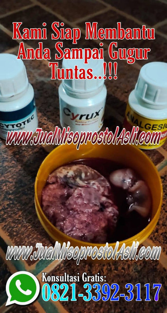 Obat Aborsi untuk Usia Kehamilan 1, 2, 3, 4 Minggu atau Obat Penggugur Kandungan 1 Bulan Tanpa Kuret yang Aman dan Efektif.