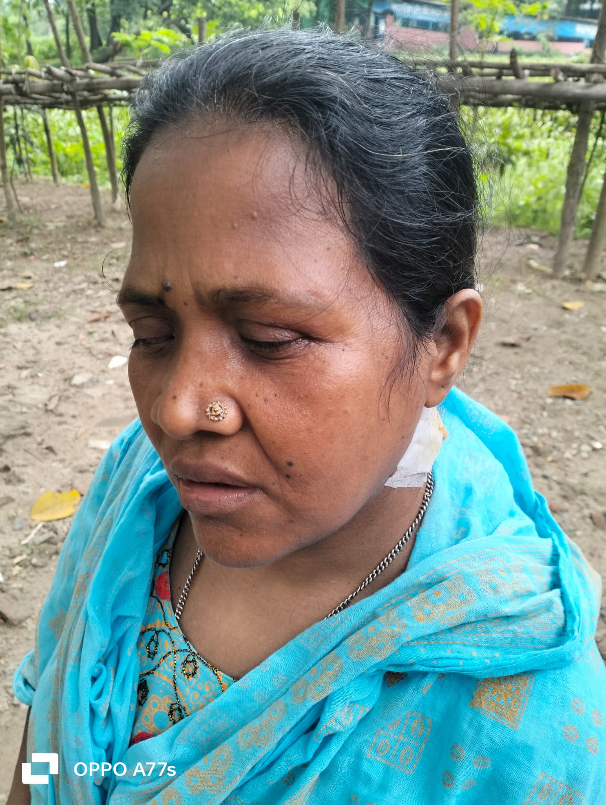 টঙ্গীতে মামলার জেরে দৃষ্টিপ্রতিবন্ধী নারীর ওপর ফের হামলার অভিযোগ
