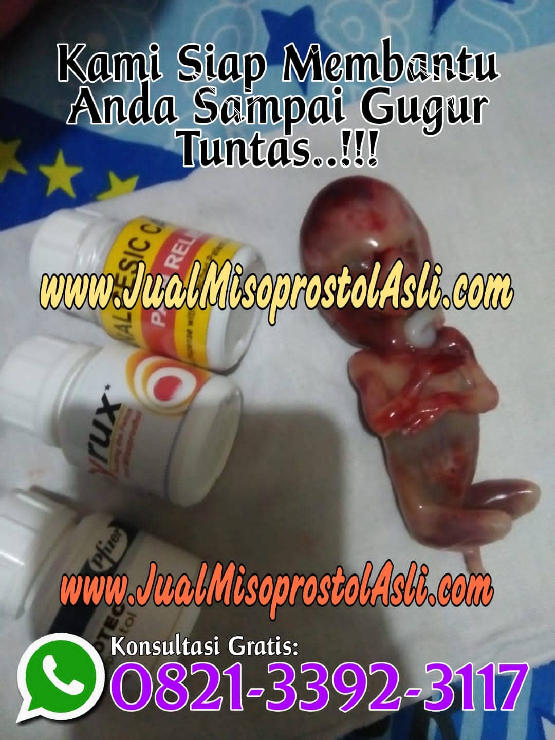 Obat Aborsi untuk Usia Kehamilan 1, 2, 3, 4 Minggu atau Obat Penggugur Kandungan 1 Bulan Tanpa Kuret yang Aman dan Efektif.