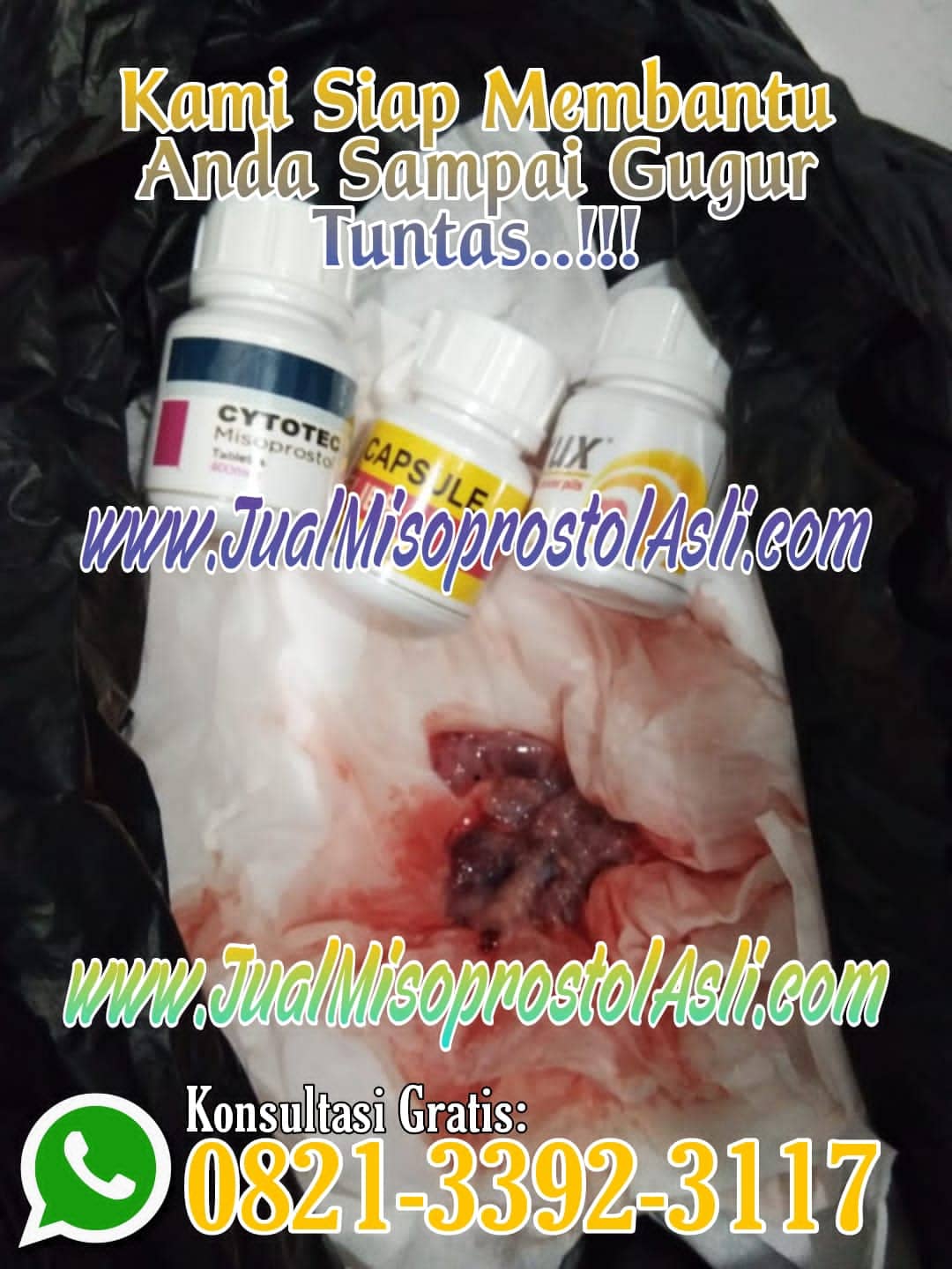 Obat Aborsi untuk Usia Kehamilan 1, 2, 3, 4 Minggu atau Obat Penggugur Kandungan 1 Bulan Tanpa Kuret yang Aman dan Efektif.
