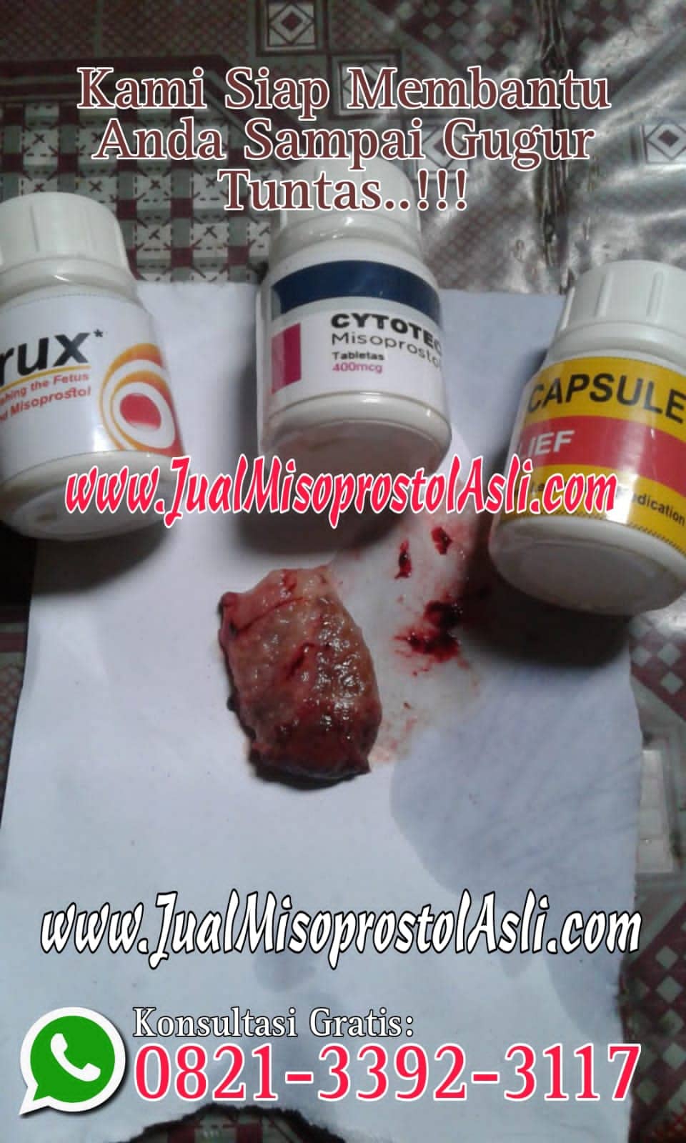Obat Aborsi untuk Usia Kehamilan 1, 2, 3, 4 Minggu atau Obat Penggugur Kandungan 1 Bulan Tanpa Kuret yang Aman dan Efektif.